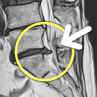 MRIġ���� �̹���