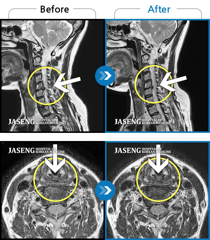 õڻѹ溴 ġ MRI  ġ-    ߰ ,  ü  ϻȰ  ޴ · ϼ̽ϴ.