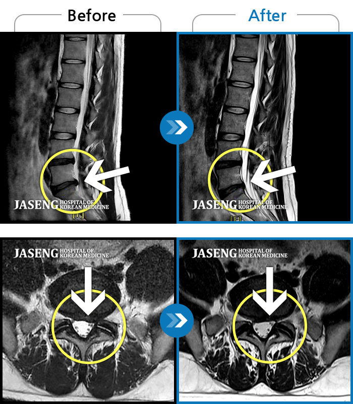 ڻѹ溴 ġ MRI  ġ- 㸮    ߹ٴڱ ۰    ӵǾ ϼ̽ϴ.