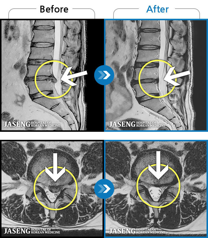 õڻѹ溴 ġ MRI  ġ-  ߰ Ż          ϻ Ȱ ϴ.