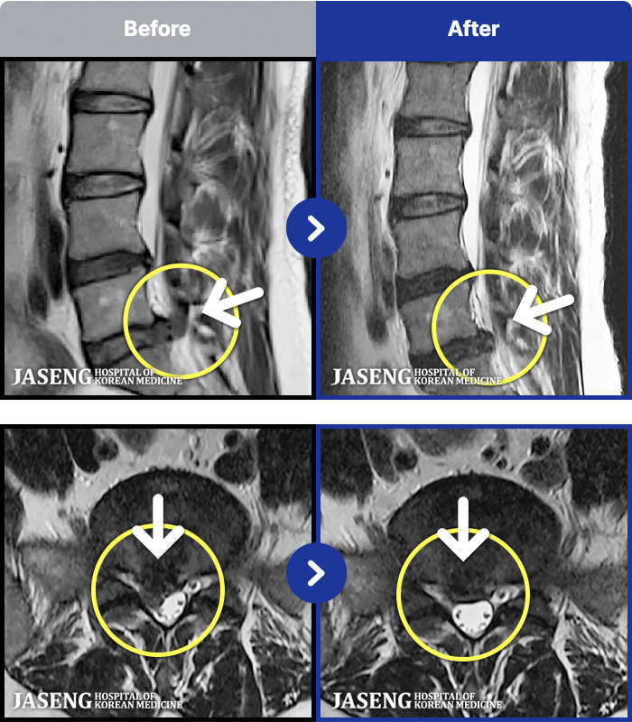 �ڻ��ѹ溴�� ġ���� MRI�� ���� ġ����-���� ���� �� ���� �����ĸ�� �� ��ü�� ����, �ٷ�����