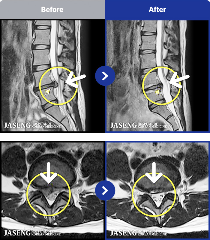 �ڻ��ѹ溴�� ġ���� MRI�� ���� ġ����-�� 1�� ���� ���� �ʴ� ���� �㸮���� ���, ������������ �̾����� ���� �� �ɾҴ� �Ͼ �� ���� ��ȭ�Ǿ� �����ϼ̽��ϴ�.