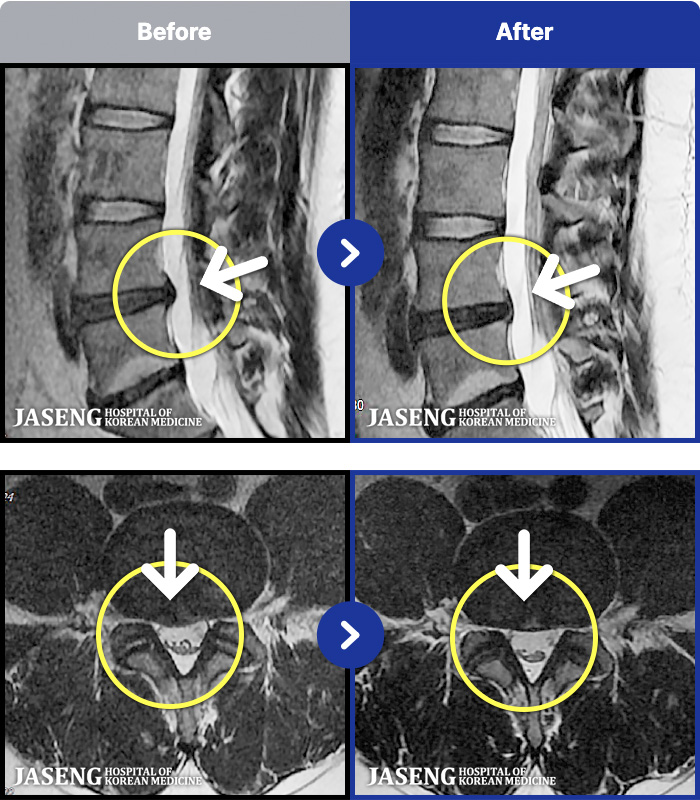 ���ڻ��ѹ溴�� ġ���� MRI�� ���� ġ����-�������� ��� �㸮���� ��ħ�� �Ͼ�� �� ������ ���ؿ�.