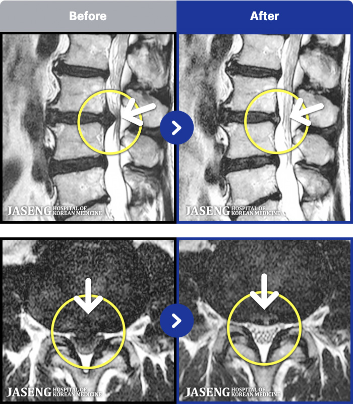 �ڻ��ѹ溴�� ġ���� MRI�� ���� ġ����-�߻��� ����� ���� ��ġ ���� ������ ����, Ư�� �߰��� ������ ���� ���� ��ָ� �޾����ϴ�.