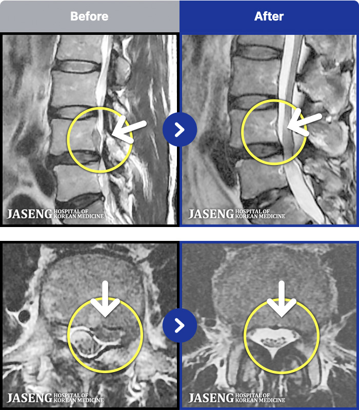 �����ڻ��ѹ溴�� ġ���� MRI�� ���� ġ����-���� ����������� ���Ͽ� ��ü� Ÿ�� �����Ͽ����ϴ�.