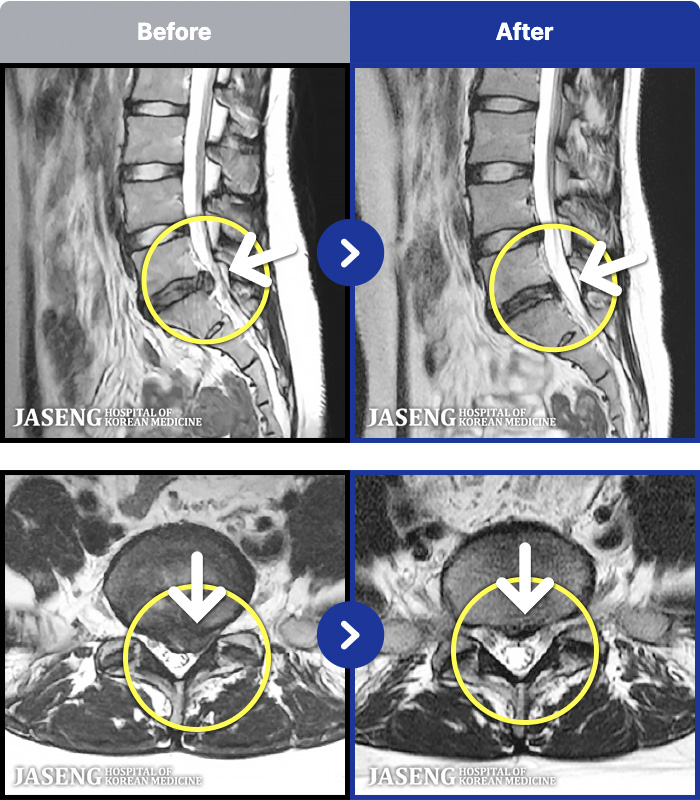 �ڻ��ѹ溴�� ġ���� MRI�� ���� ġ����-����� ���� ���� �������� ������ ��������ϴ�.