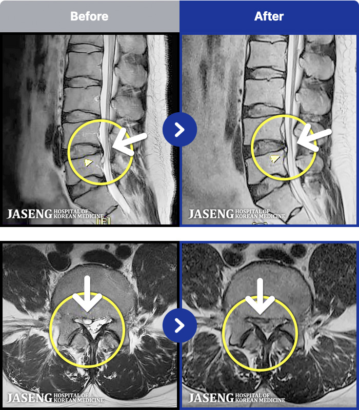 �����ڻ����ǿ� ġ���� MRI�� ���� ġ����-���� �㸮���� ���, ��������� �̾����� �������� ��� �� ���� ��ȭ�Ǿ� �����ϼ̽��ϴ�.
