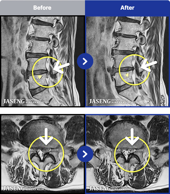 �����ڻ����ǿ� ġ���� MRI�� ���� ġ����-��ð� �ɰų�, �Ͼ�� ���� �� ������ ���� ������ ��ݺ��� �߳����� Į�� °�� ���� ������ ���� ������ �־����ϴ�. 