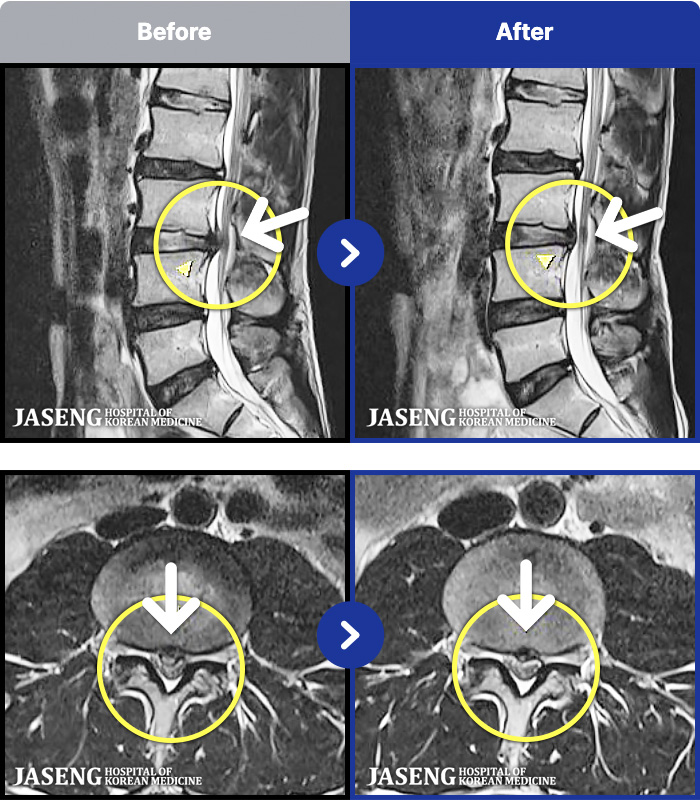 �ڻ��ѹ溴�� ġ���� MRI�� ���� ġ����-�㸮���� ��� ����,  ���� �� ���� �ٸ� ������ ���� ��ȭ�Ǿ� �����ϼ̽��ϴ�.