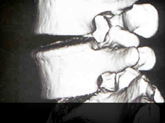 인천자생한방병원 허리질환 퇴행성디스크-정상척추에 관련된 이미지 입니다.
