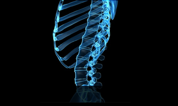 인천자생한방병원 허리질환 척추전만증-정상적인 사람의 척추 모습입니다.